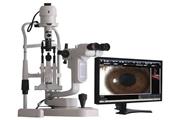 تجهیز کلینیک احمدیه تربت حیدریه به دستگاه اسلیت لمپ چشم پزشکی